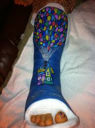 Use Sharpie Paint Pens To Draw On Casts Sharpie Paint Sharpie Paint Pens Paint Pens