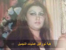 هيا الشعيبي قبل عملية التجميل. Ù‡Ø¨Ø© Ù†ÙˆØ± Ù‚Ø¨Ù„ Ø¹Ù…Ù„ÙŠØ§Øª Ø§Ù„ØªØ¬Ù…ÙŠÙ„ ÙˆØ¨Ø¹Ø¯ Youtube