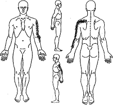 Body Chart Of Reported Pain Download Scientific Diagram