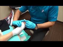 What To Do If Your Bandage Or Dressing Gets Wet After A Surgery With Dr Paul Steinke Facfas Of Foot And Ankle Associates Of North Getting Wet Bandage Surgery