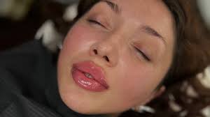 Best clinics for anti-wrinkle injections near me in St Albans