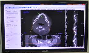 Digital Charting Saipan Sda Dental Clinic Smiles Today