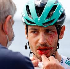 Tony martin hat keine chance mehr auszuweichen, knallt ins schild und stürzt übel. Tour De France Zuschauerin Mit Pappschild Sorgt Fur Schweren Massencrash Welt