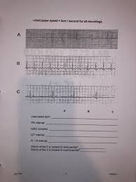 Solved Chart Paper Speed 2cm Second For All Recordin