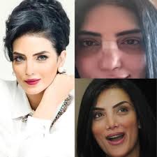 ألغى الطبيب الأمريكي المعالج للفنانة المصرية حورية فرغلي، عملية التجميل قبل دقائق من خضوعها لها، اليوم الخميس، وذلك بعدما اكتشف شيئا مفاجئا. Ø­Ù‚ÙŠÙ‚Ø© ØµÙˆØ±Ø© Ø­ÙˆØ±ÙŠØ© ÙØ±ØºÙ„ÙŠ Ø§Ù„ØªÙŠ Ø§Ø«Ø§Ø±Øª Ø§Ù„Ø¬Ø¯Ù„ Ø¨Ø¹Ø¯ Ø¹Ù…Ù„ÙŠØªÙ‡Ø§ Ø£Ù†Ø§ Ø³Ù„ÙˆÙ‰ Ø§Ù†Ø§ Ø³Ù„ÙˆÙ‰ Anasalwa Ù…Ø´Ø§Ù‡ÙŠØ±