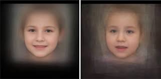 PURA Syndrome: Clinical Delineation and Genotype-Phenotype Study in 32  Individuals with Review of Published Literature