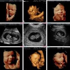 We did not find results for: 9 3d 4d Ultrasound Ideas 4d Ultrasound Ultrasound Ultrasound Pictures