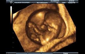 10 hafta gebelik hamilelik