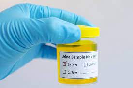 Check spelling or type a new query. Waspadai Penyebab Urine Berwarna Hijau Merah Ungu Oranye Dan Seperti Teh Halaman All Kompas Com