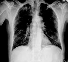 Http Www Uask2016 Com Files Poster Sunu Bildirileri Pdf