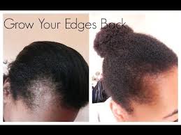 How To Grow Your Edges Back Natural Hair Styles Edges Hair Grow Hair