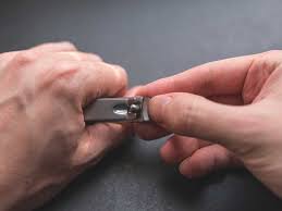 4 june at 05:19 ·. Yellow Nails Causes Treatment And Prevention