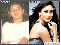 Before After Pics Of Celebrities Bollywood Celebrities Celebrity Dresses Celebrities Before And After
