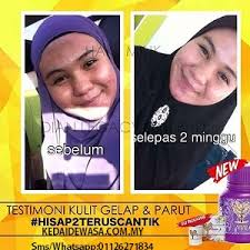 Sebelum dan selepas menggunakan dianz vitaminantara testimoni yang dian'z vitamin c & e 12000mg selepas sebulan menggunakan nya,.dan masalah yg dapat di selesai kan.eyebag. Dianz Vitamin Review Testimoni Dianz Vitamin C Harga Dianz Vitamin