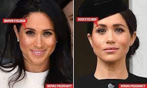 The stigma surrounding plastic surgery is disappearing as more mothers share their experiences, and why surg. Meghan Markle Plastic Surgery Nose Job Teeth Before And After Meghan Markle Hair Meghan Markle Plastic Surgery Megan Markle Makeup