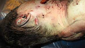Jun 15, 2016 · reeva steenkamp's dead body is seen in graphic crime scene photos released after her father pleaded for them to be made them public to show what oscar pistorius did to her. Jodi Arias Crime Scene Photos Warning Graphic Crime Online