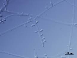 Image result for Erythrococca trichogyne