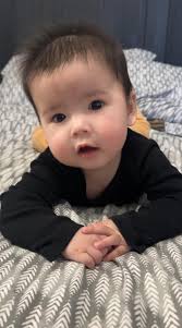 This maybe a long shot but my 10 month old has bilateral cerebral palsy,  and is trying so hard to crawl but every time she moves her head drops  multiple times and