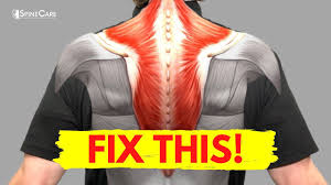 How To Fix Muscle Knots In Your Neck And Shoulder In 30 Seconds Youtube Muscle Knots Knots In Neck Muscle Muscle Knots In Back