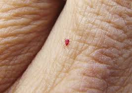 Some bugs, like mosquitos, bite to feed. What Do Chigger Bites Look Like How To Get Rid Of Berry Bugs