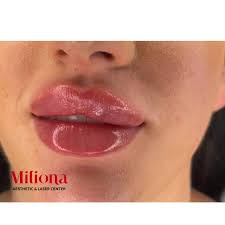 We did not find results for: Miliona Aesthetic Startseite Facebook