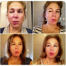 Namaste Pembroke Pines Acupuncture