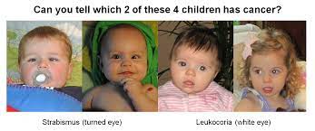 With cancer, each tumor has this set of genes as well. Signs And Symptoms Of Retinoblastoma We C Hope