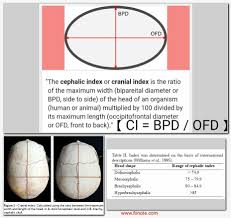 Cephalic Index Biparietal Diameter Occipitofrontal