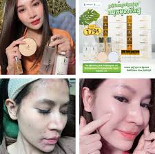 មាតាដៃ១០០ #កូនស្វា