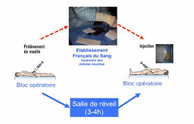 Erectile Dysfunction Following Treatment For Prostate Cancer Promising Results From The First Transplants Of Stem Cells Into The Penis Newsroom Inserm