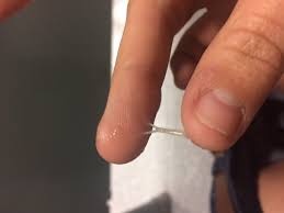 After implantation has occurred, there is an increasing level of discharge which is known as leukorrhea. Yellow Snot Like Cm 12dpo Trying To Conceive Forums What To Expect