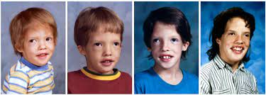 Behavior Of 10 Patients With Fg Syndrome Opitz Kaveggia Syndrome And The P R961w Mutation In The Med12 Gene Abstract Europe Pmc