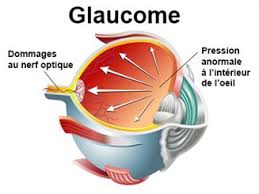 Toutes les définitions santé, symptômes et traitements sont sur docteurclic. Douleur Oculaire Symptomes Traitement Definition Docteurclic Com
