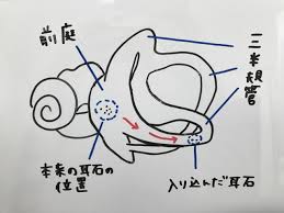 めまい 処方 全国から薬局 ドラッグストアを探す