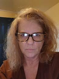 Embracing self-acceptance with facial muscle atrophy