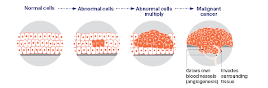 The grade describes the appearance of the cancerous cells. What Is Cancer Cancer Council