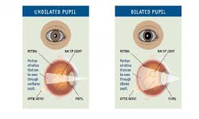 is eye dilation necessary in an eye examination