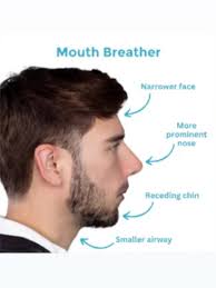 Today course ( intraosseous anesthesia ) Quick sleeper