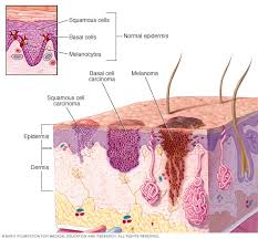 For people without a history of skin cancer in their families, no studies have been done to test the effectiveness of routine screening for melanoma. Skin Cancer Symptoms And Causes Mayo Clinic