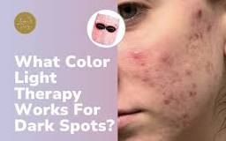 What Color Light Therapy Works For Dark Spots? | Lumivisage