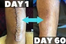 How long after knee replacement can i drive. Riding And Driving In A Car After Knee Replacement Surgery 7 Tips