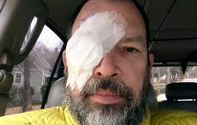 Eye Surgery #8 Update
