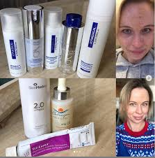 Black And White Bleaching Cream Results Pin On Skin Care