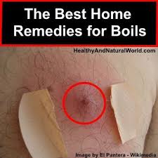 Use the boiled water to rinse the infected area. 7 Boil Remedies Ideas Boil Remedies Remedies Natural Home Remedies