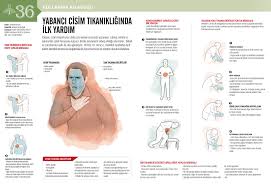 Bogulma Solunum Yolu Tikanma Infografik Grafik Infografik Saglik Ve Fitness Alternatif Saglik