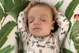 Fundraiser for Christiane Knighten by Hunter Knighten : The Extraordinary  Hunt- Treacher Collins Syndrome