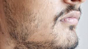 He can grow a full beard, minus the mustache, why is it that people grow facial hair in different places like this? How To Say Goodbye To A Patchy Beard Man Cave Sydney