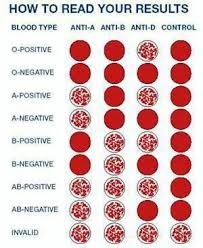 How To Read Your Result Blood Type Medical Laboratory