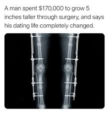 Jackson Roloff's leg-lengthening surgery success