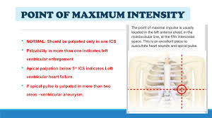 Image result for Point of Maximum Impulse